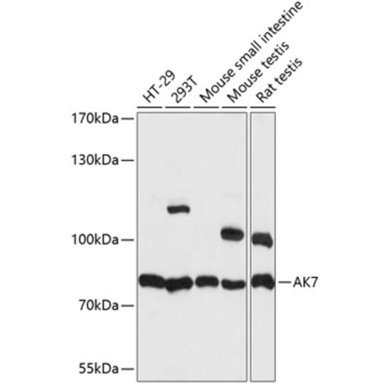 Western Blot - Anti-AK7 Antibody (A91374) - Antibodies.com