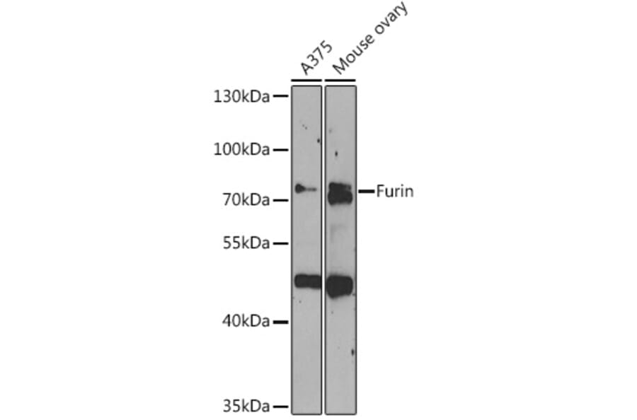 Western Blot - Anti-Furin Antibody (A91375) - Antibodies.com