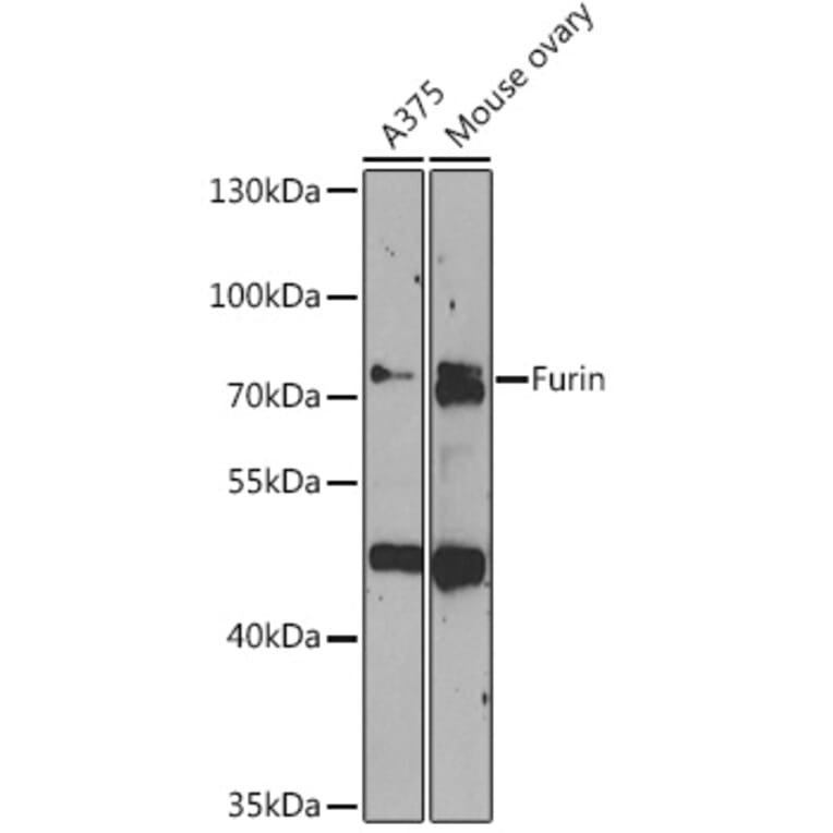 Western Blot - Anti-Furin Antibody (A91375) - Antibodies.com