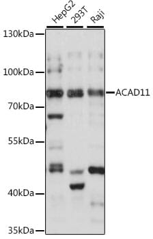 Western blot analysis of extracts of various cell lines, using Anti-ACAD11 Antibody (A16153) at 1:1,000 dilution.
Secondary antibody: Goat Anti-Rabbit IgG (H+L) (HRP) (AS014) at 1:10,000 dilution.
Lysates / proteins: 25µg per lane.
Blocking buffer: 3% non-fat dry milk in TBST.
Detection: ECL Basic Kit (RM00020).
Exposure time: 30s.