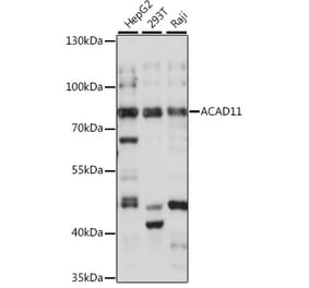 Western Blot - Anti-ACAD11 Antibody (A91376) - Antibodies.com