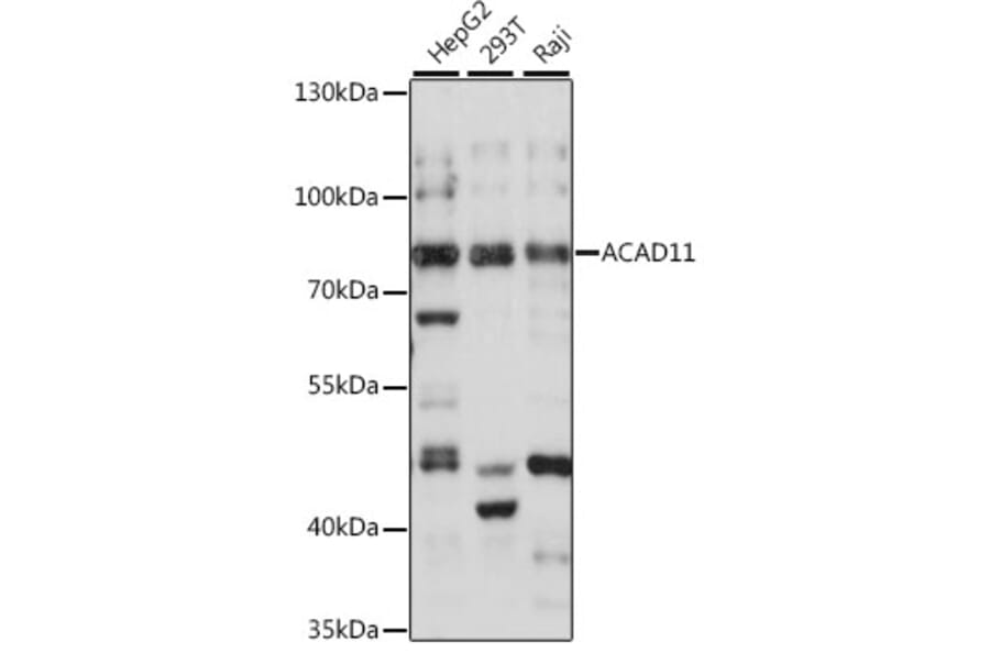 Western Blot - Anti-ACAD11 Antibody (A91376) - Antibodies.com