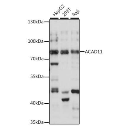 Western Blot - Anti-ACAD11 Antibody (A91376) - Antibodies.com