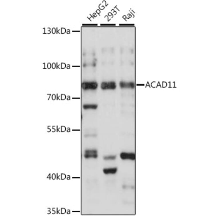 Western Blot - Anti-ACAD11 Antibody (A91376) - Antibodies.com