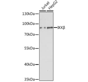 Western Blot - Anti-IKK beta Antibody (A91378) - Antibodies.com