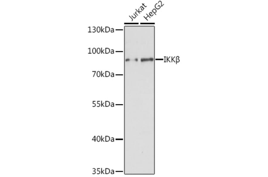 Western Blot - Anti-IKK beta Antibody (A91378) - Antibodies.com