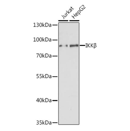 Western Blot - Anti-IKK beta Antibody (A91378) - Antibodies.com