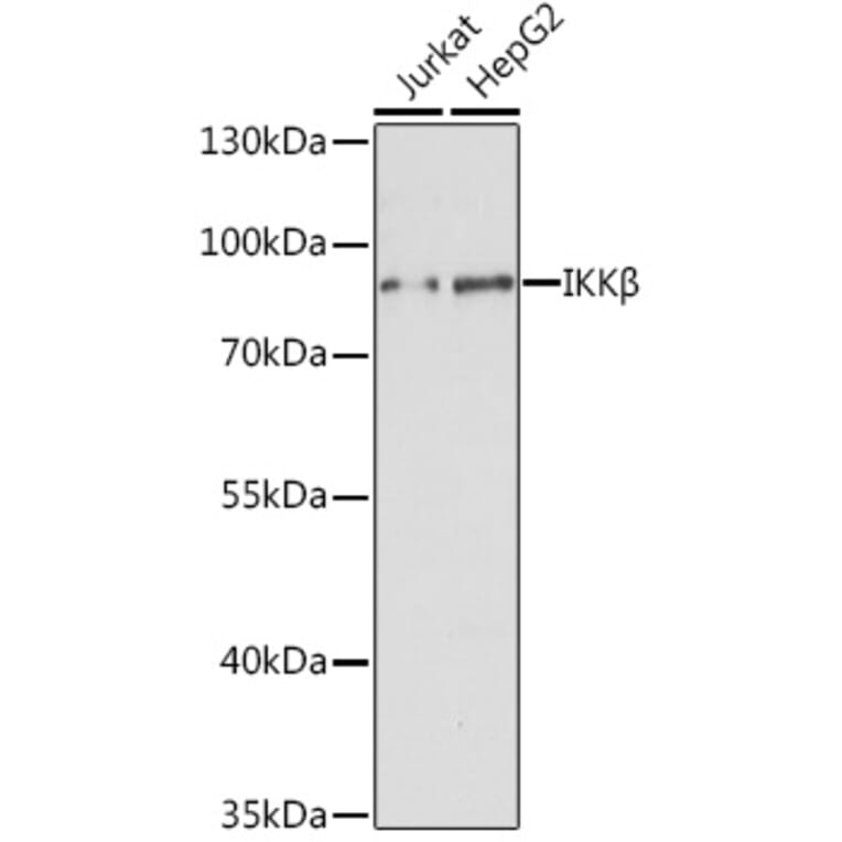 Western Blot - Anti-IKK beta Antibody (A91378) - Antibodies.com