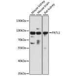 Western Blot - Anti-PATL1 Antibody (A13170) - Antibodies.com