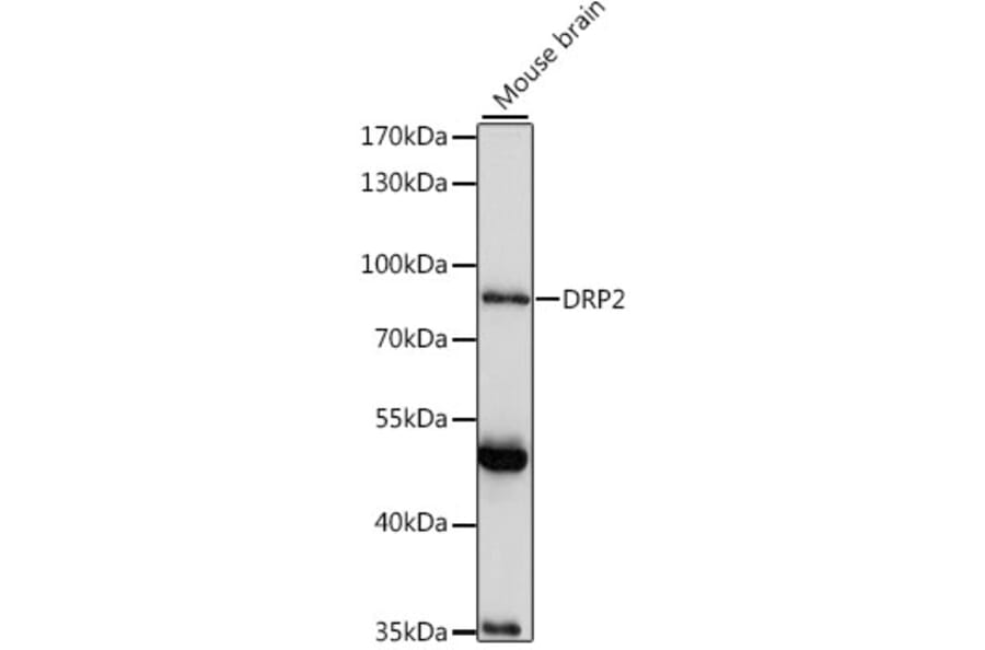 Western Blot - Anti-DRP2 Antibody (A91380) - Antibodies.com