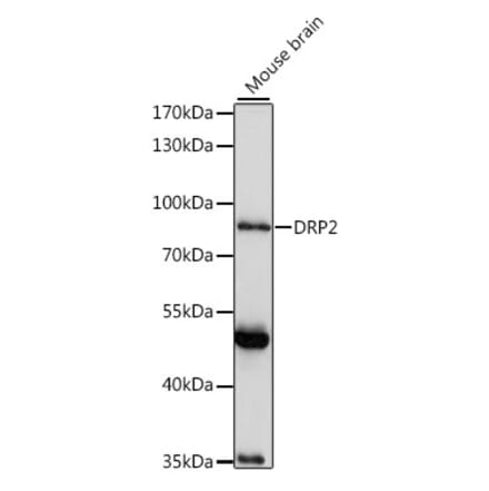 Western Blot - Anti-DRP2 Antibody (A91380) - Antibodies.com