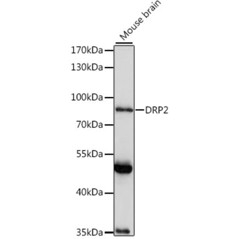 Western Blot - Anti-DRP2 Antibody (A91380) - Antibodies.com