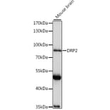 Western Blot - Anti-DRP2 Antibody (A91380) - Antibodies.com