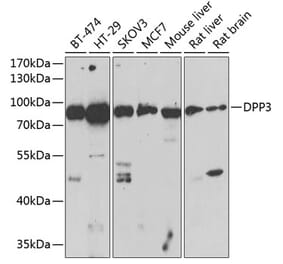 Western Blot - Anti-DPP3 Antibody (A91381) - Antibodies.com