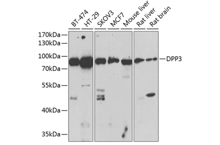Western Blot - Anti-DPP3 Antibody (A91381) - Antibodies.com
