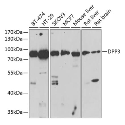 Western Blot - Anti-DPP3 Antibody (A91381) - Antibodies.com