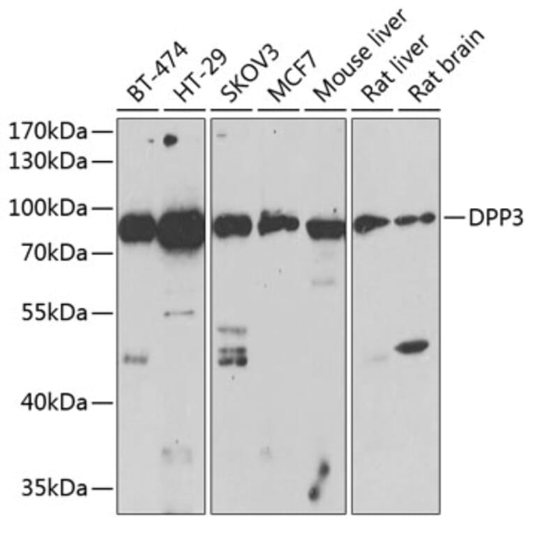 Western Blot - Anti-DPP3 Antibody (A91381) - Antibodies.com