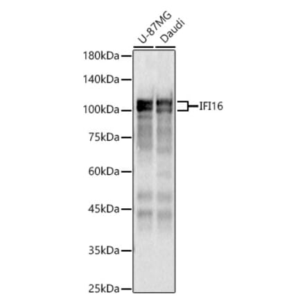 Western Blot - Anti-IFI16 Antibody (A91382) - Antibodies.com