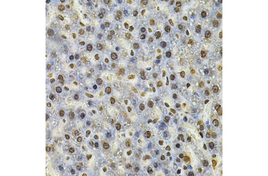 Immunohistochemistry - Anti-IFI16 Antibody (A91382) - Antibodies.com
