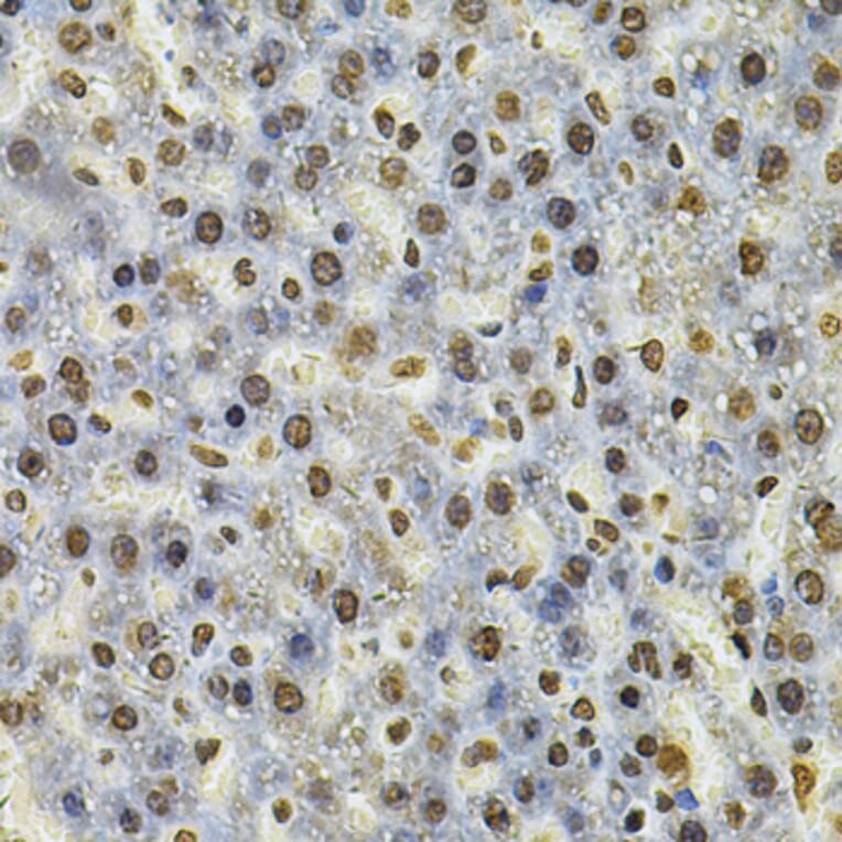 Immunohistochemistry - Anti-IFI16 Antibody (A91382) - Antibodies.com