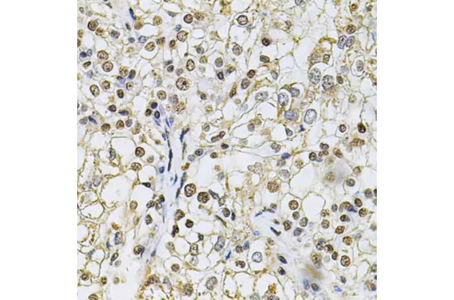Immunohistochemistry - Anti-IFI16 Antibody (A91382) - Antibodies.com