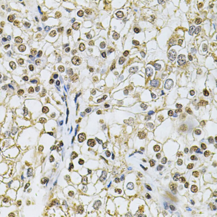 Immunohistochemistry - Anti-IFI16 Antibody (A91382) - Antibodies.com