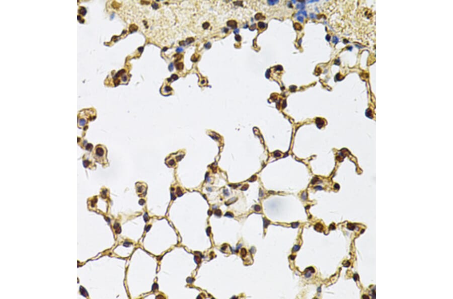 Immunohistochemistry - Anti-IFI16 Antibody (A91382) - Antibodies.com