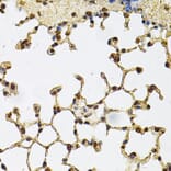 Immunohistochemistry - Anti-IFI16 Antibody (A91382) - Antibodies.com