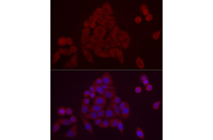 Immunofluorescence - Anti-PDE10A Antibody (A91384) - Antibodies.com