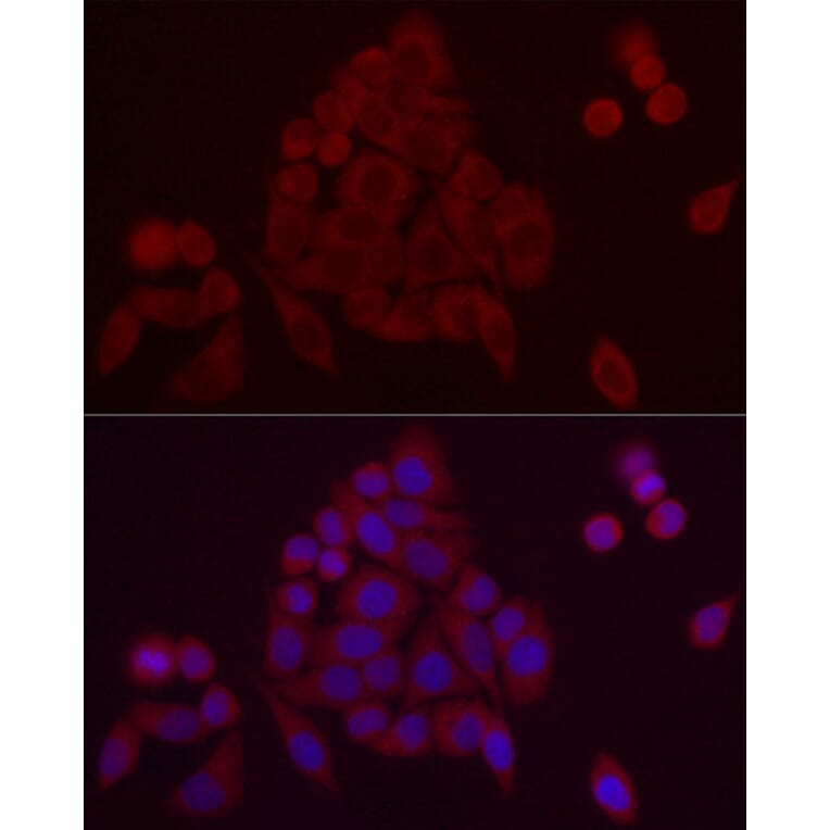 Immunofluorescence - Anti-PDE10A Antibody (A91384) - Antibodies.com