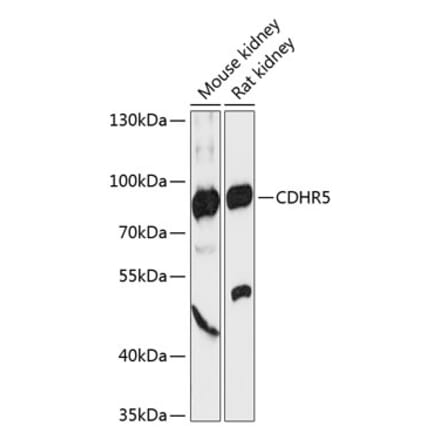 Western Blot - Anti-MUPCDH Antibody (A91385) - Antibodies.com
