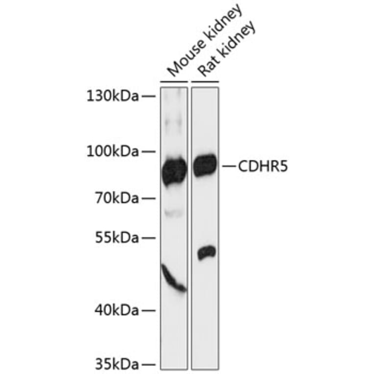 Western Blot - Anti-MUPCDH Antibody (A91385) - Antibodies.com
