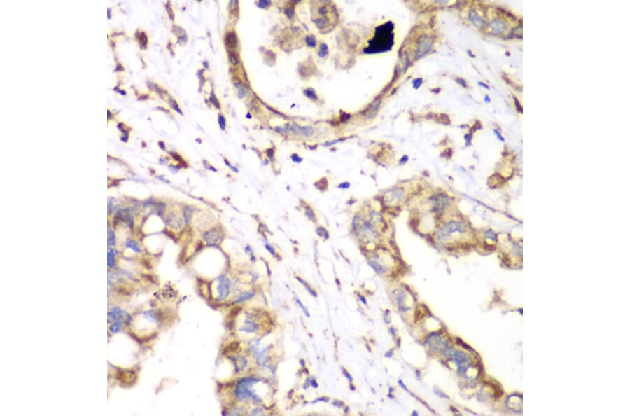 Immunohistochemistry - Anti-HADHA Antibody (A91386) - Antibodies.com