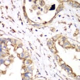 Immunohistochemistry - Anti-HADHA Antibody (A91386) - Antibodies.com