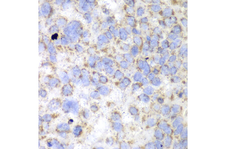 Immunohistochemistry - Anti-HADHA Antibody (A91386) - Antibodies.com