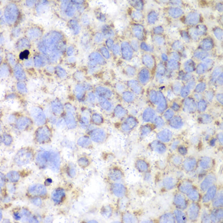 Immunohistochemistry - Anti-HADHA Antibody (A91386) - Antibodies.com