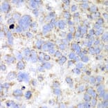 Immunohistochemistry - Anti-HADHA Antibody (A91386) - Antibodies.com