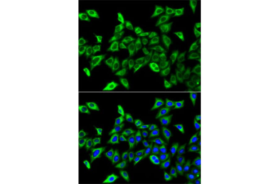 Immunofluorescence - Anti-HADHA Antibody (A91386) - Antibodies.com