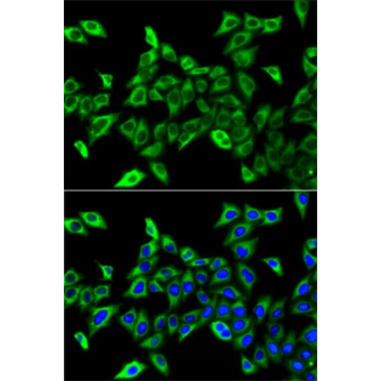 Immunofluorescence - Anti-HADHA Antibody (A91386) - Antibodies.com