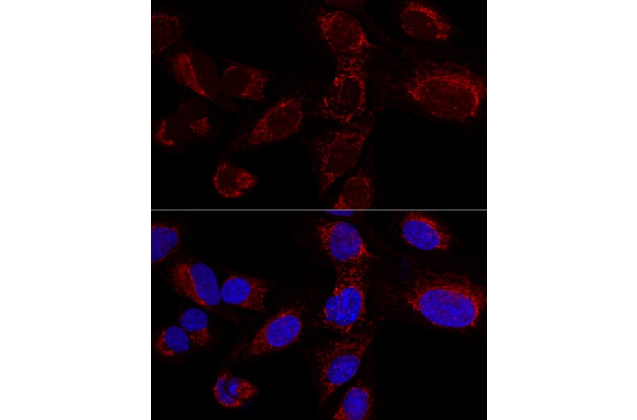 Immunofluorescence - Anti-HADHA Antibody (A91386) - Antibodies.com