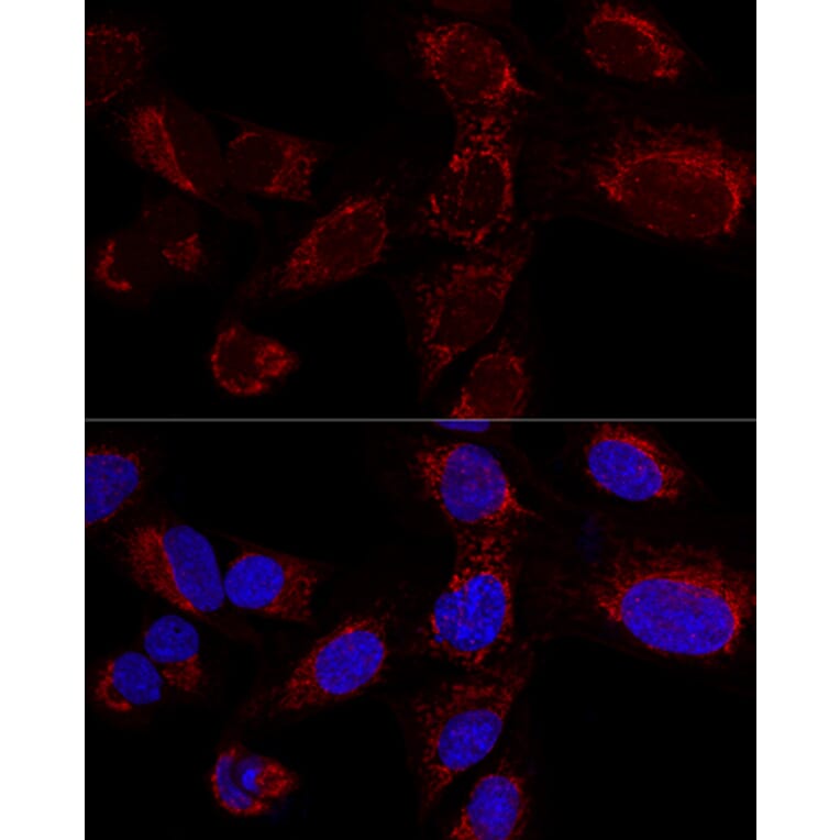 Immunofluorescence - Anti-HADHA Antibody (A91386) - Antibodies.com