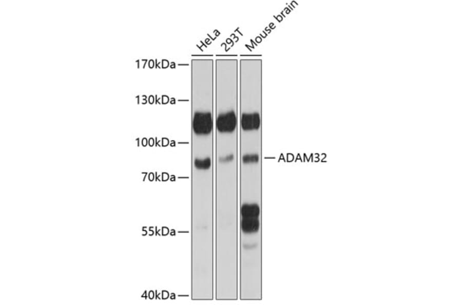 Western Blot - Anti-ADAM32 Antibody (A91387) - Antibodies.com