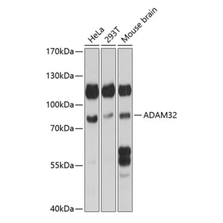 Western Blot - Anti-ADAM32 Antibody (A91387) - Antibodies.com