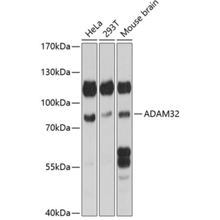 Western Blot - Anti-ADAM32 Antibody (A91387) - Antibodies.com