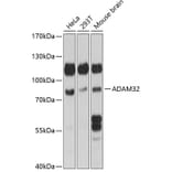 Western Blot - Anti-ADAM32 Antibody (A91387) - Antibodies.com