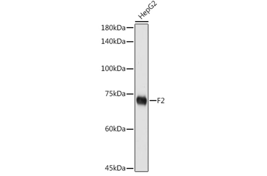 Western Blot - Anti-Thrombin Antibody (A91388) - Antibodies.com