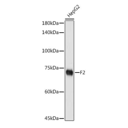 Western Blot - Anti-Thrombin Antibody (A91388) - Antibodies.com