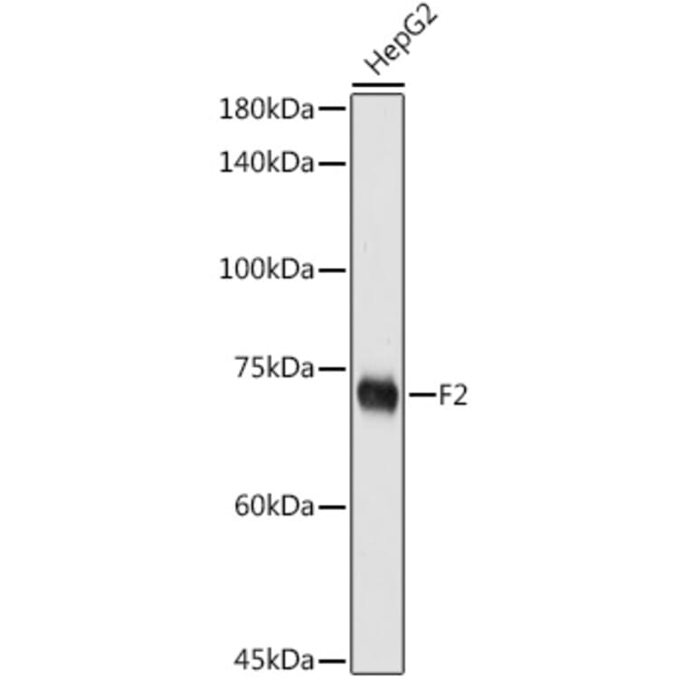 Western Blot - Anti-Thrombin Antibody (A91388) - Antibodies.com