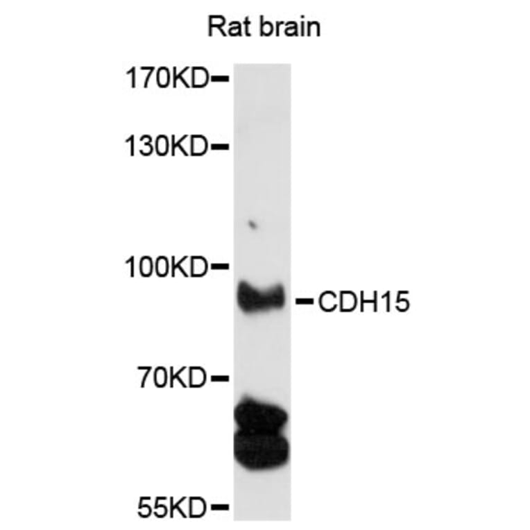 Western Blot - Anti-CDH15 Antibody (A13794) - Antibodies.com