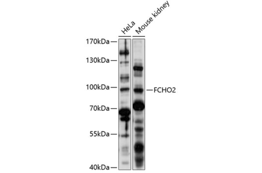 Western Blot - Anti-FCHO2 Antibody (A91391) - Antibodies.com
